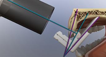 Endodontic Radiology