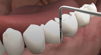 Periodontal Examination