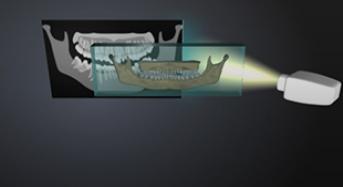 Theory of Panoramic Tomography